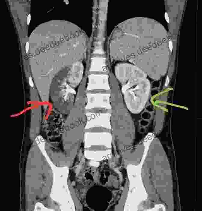 CT Scan Image Of The Abdomen Showing The Liver, Kidneys, And Intestines Spine Essentials Handbook: A Bulleted Review Of Anatomy Evaluation Imaging Tests And Procedures