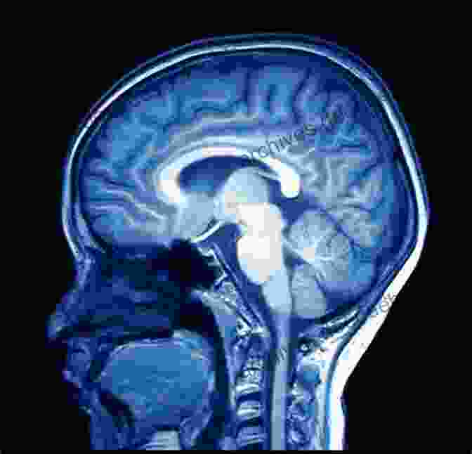 MRI Scan Image Of The Brain Showing The Brain And Skull Spine Essentials Handbook: A Bulleted Review Of Anatomy Evaluation Imaging Tests And Procedures