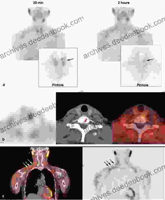 Nuclear Medicine Imaging Image Of The Thyroid Gland Spine Essentials Handbook: A Bulleted Review Of Anatomy Evaluation Imaging Tests And Procedures