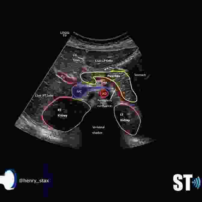 Ultrasound Image Of The Abdomen Showing The Liver, Kidneys, And Intestines Spine Essentials Handbook: A Bulleted Review Of Anatomy Evaluation Imaging Tests And Procedures