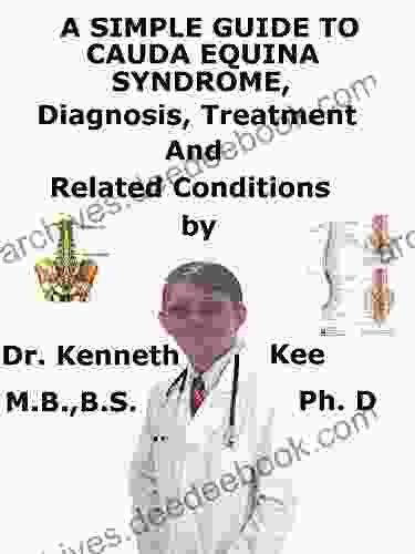 A Simple Guide To Cauda Equina Syndrome Diagnosis Treatment And Related Conditions