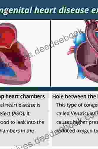 Adult Congenital Heart Disease in Clinical Practice