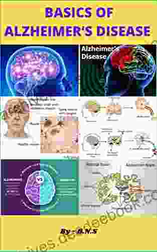 Basics Of Alzheimer S Disease