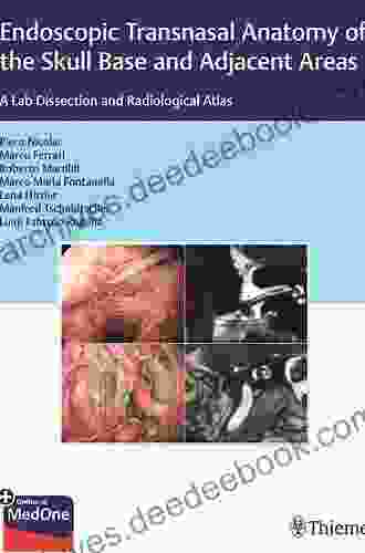 Endoscopic Transnasal Anatomy Of The Skull Base And Adjacent Areas: A Lab Dissection And Radiological Atlas