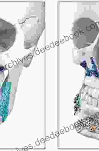 Principles of Internal Fixation of the Craniomaxillofacial Skeleton: Trauma and Orthognathic Surgery